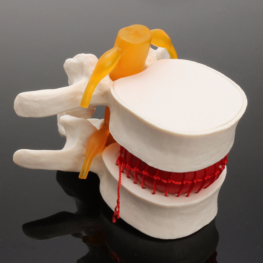 Demonstration Model Of Medical Human Lumbar intervertebral Disc