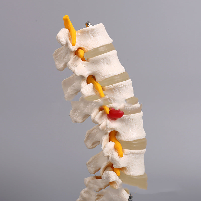 Medical Human Organ Model 5 Lumbar Vertebrae With Sacrum