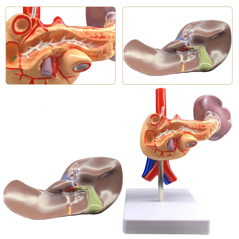 Medical Liver Planing Model Pancreas Spleen Duodenum Pancreas Structure Model