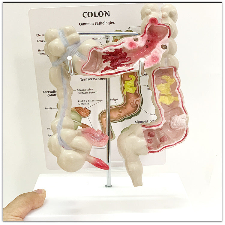 Medical Human Anatomical Intestine Model