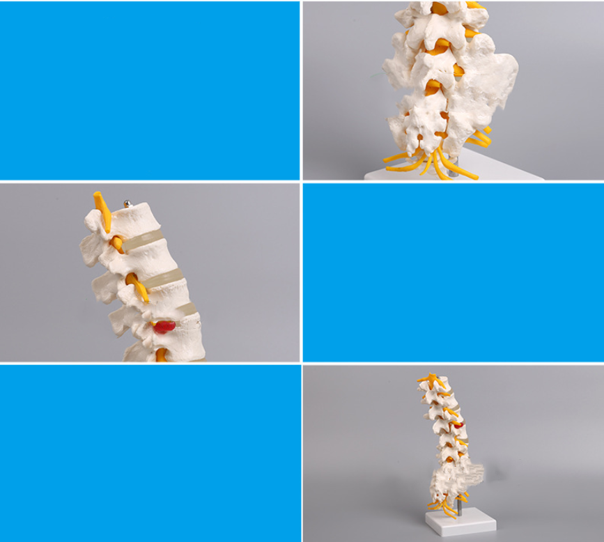 Medical Human Organ Model 5 Lumbar Vertebrae With Sacrum