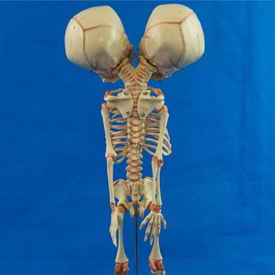 Double-headed Infant Bone Model For Medical Teaching