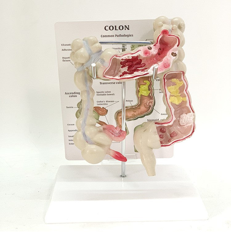 Medical Human Anatomical Intestine Model