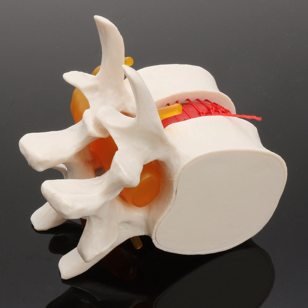 Demonstration Model Of Medical Human Lumbar intervertebral Disc