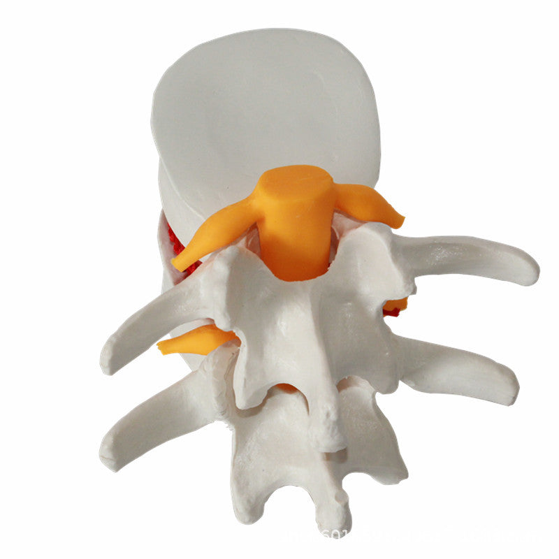 Demonstration Model Of Medical Human Lumbar intervertebral Disc