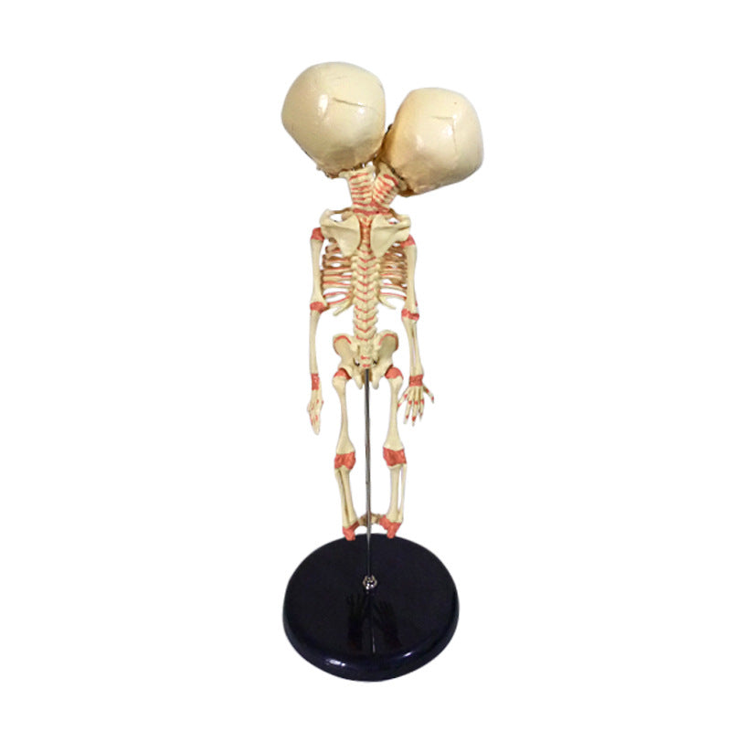 Double-headed Infant Bone Model For Medical Teaching